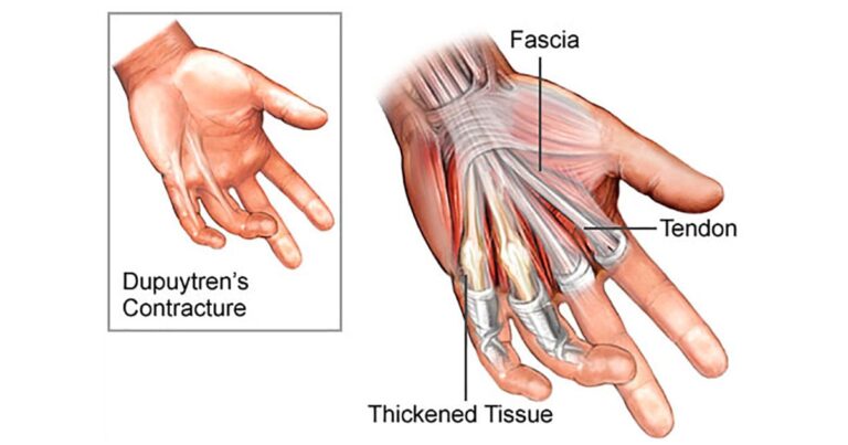 des mains serrant un contrat de rupture